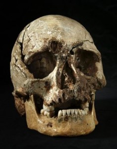 The skull of Cheddar Man, with the clearly visible hole above the eye socket.