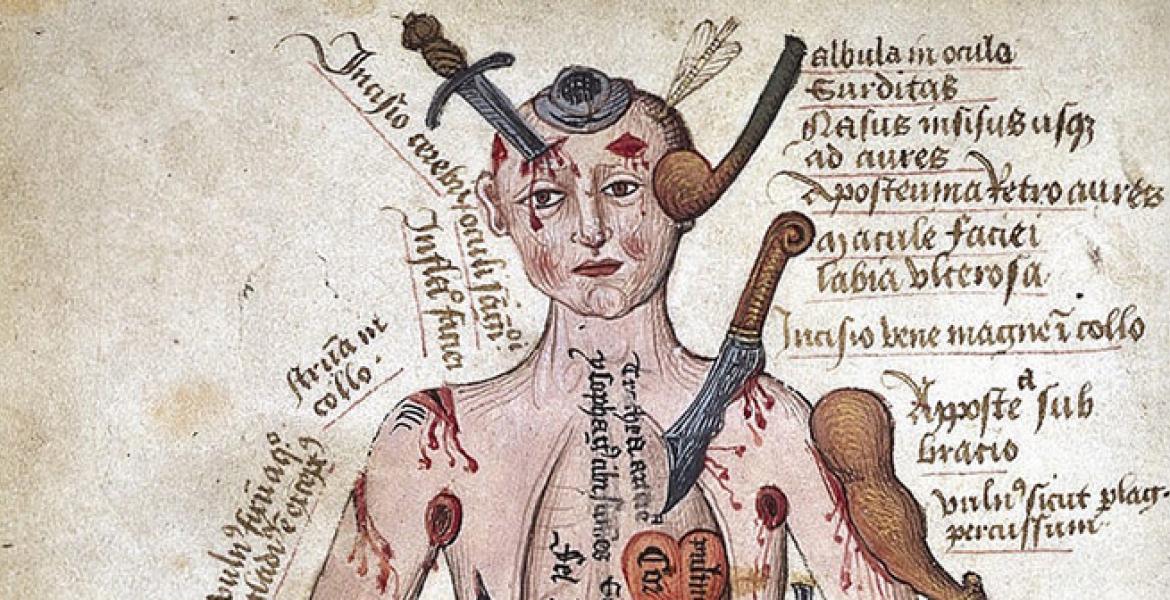 Medicine through the ages quiz Quiz: Medicine through the Ages | Get History